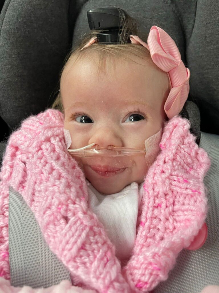 Rare condition hasn’t stopped Nora smiling - NHSGGC