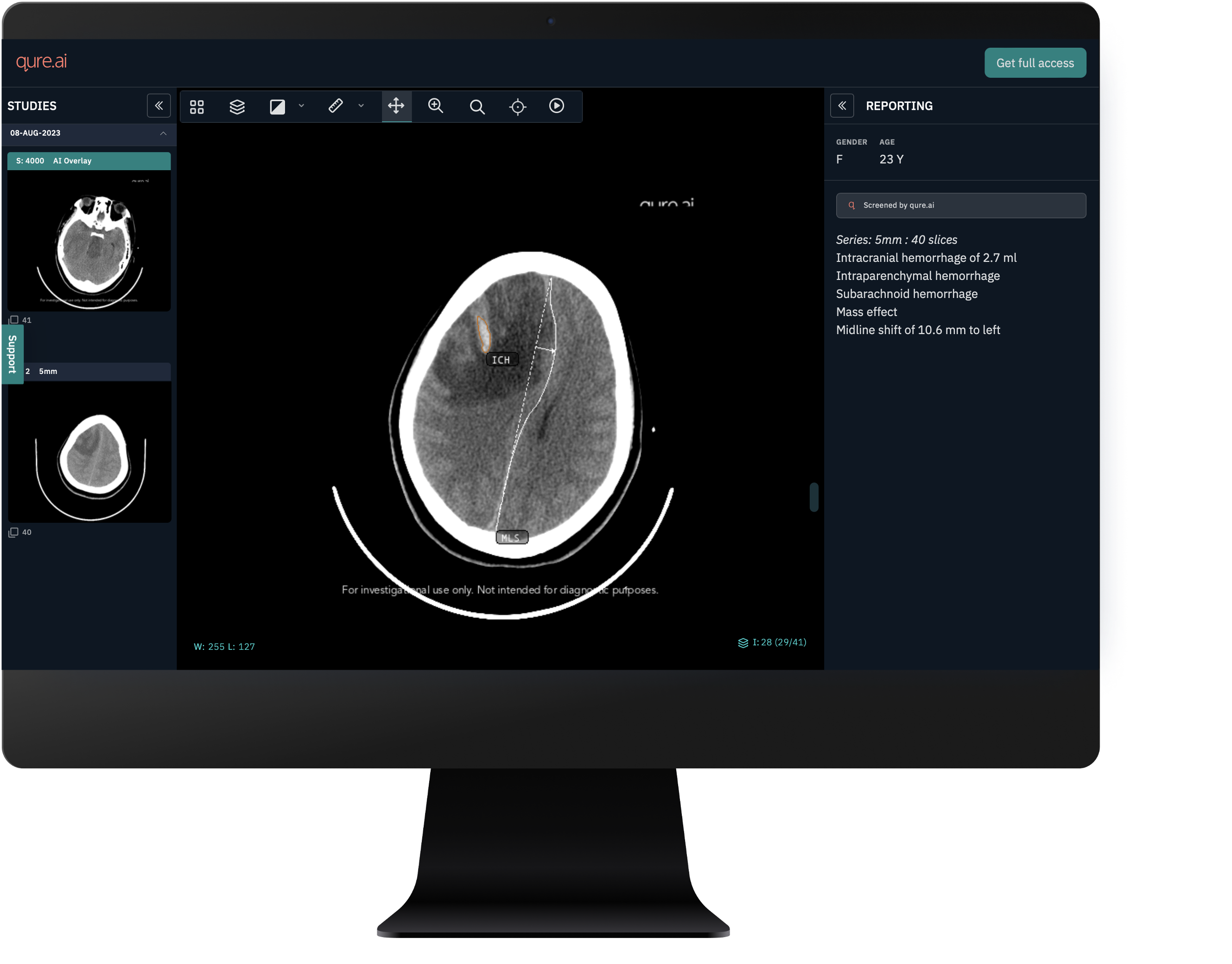 UK First – Queen Elizabeth University Hospital implements AI CT scan technology to help reduce A&E pressures